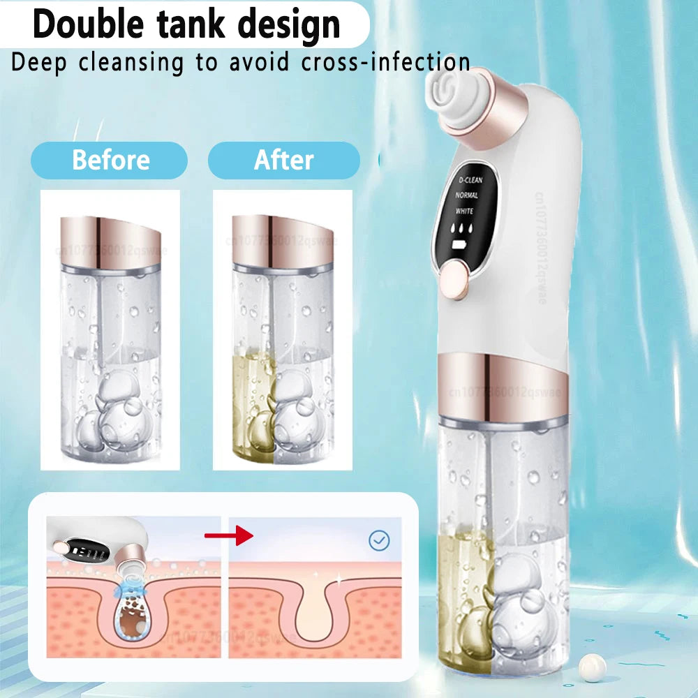 Blackhead Vacuum
