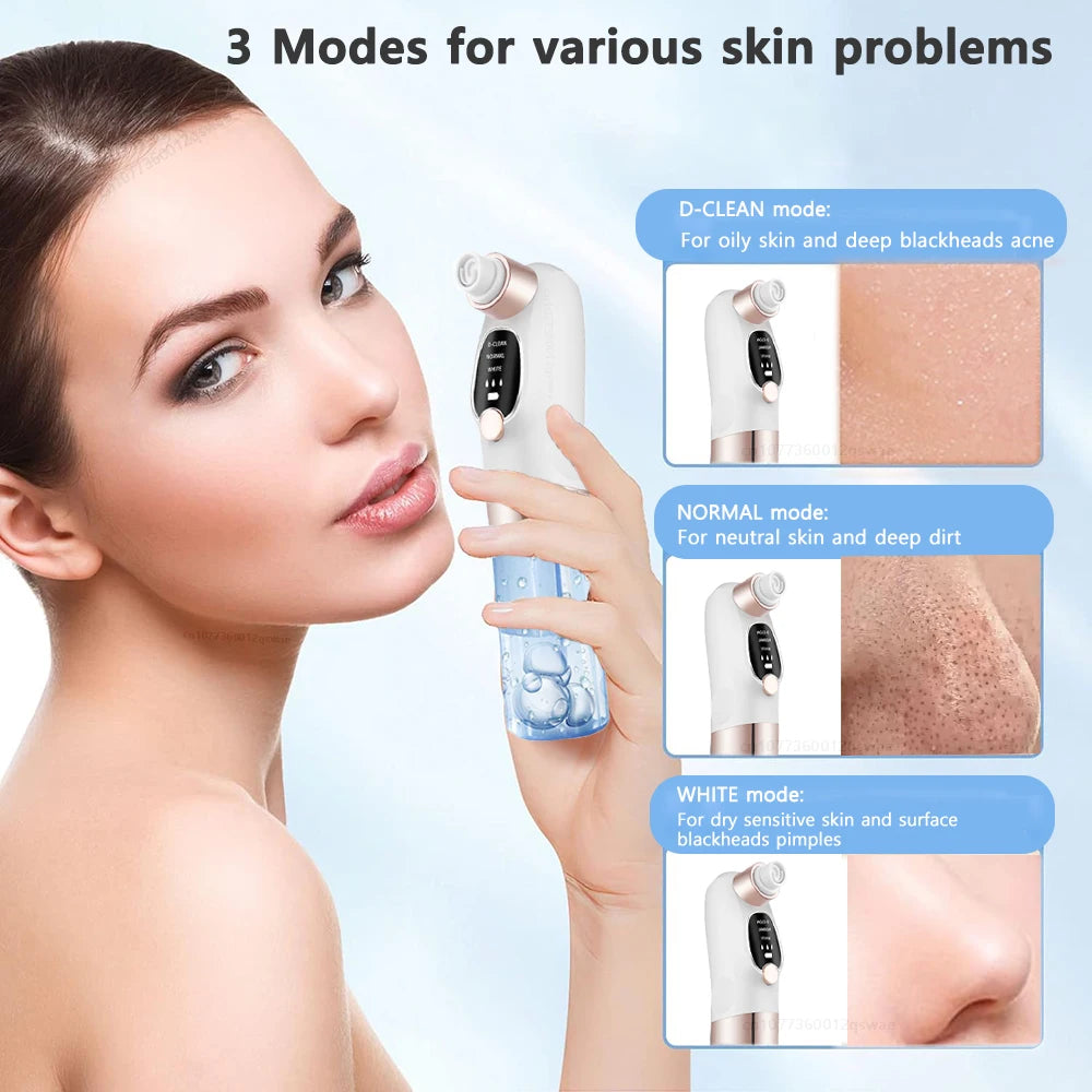 Blackhead Vacuum