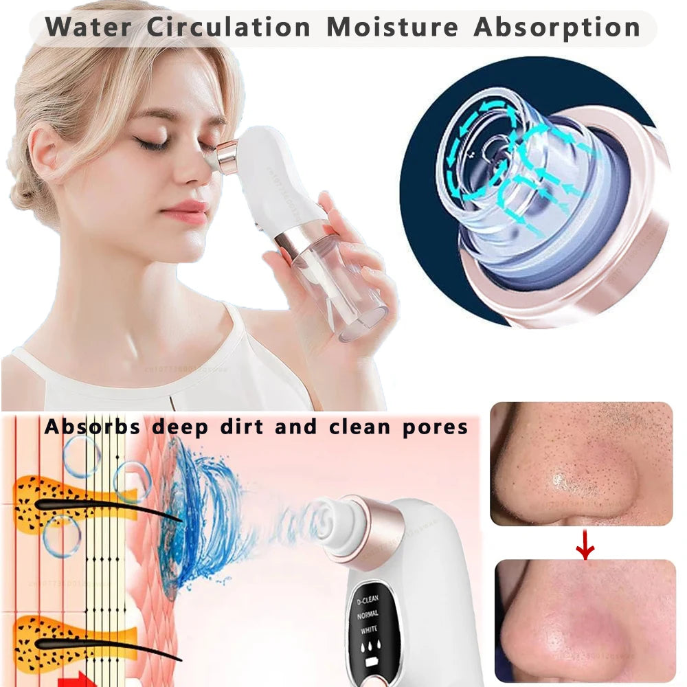 Blackhead Vacuum