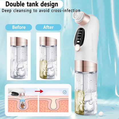 Blackhead Vacuum