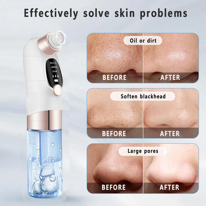 Blackhead Vacuum